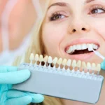 Teeth Whitening 101: A Popular Cosmetic Dentistry Solution