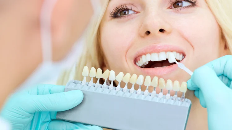 Teeth Whitening 101: A Popular Cosmetic Dentistry Solution