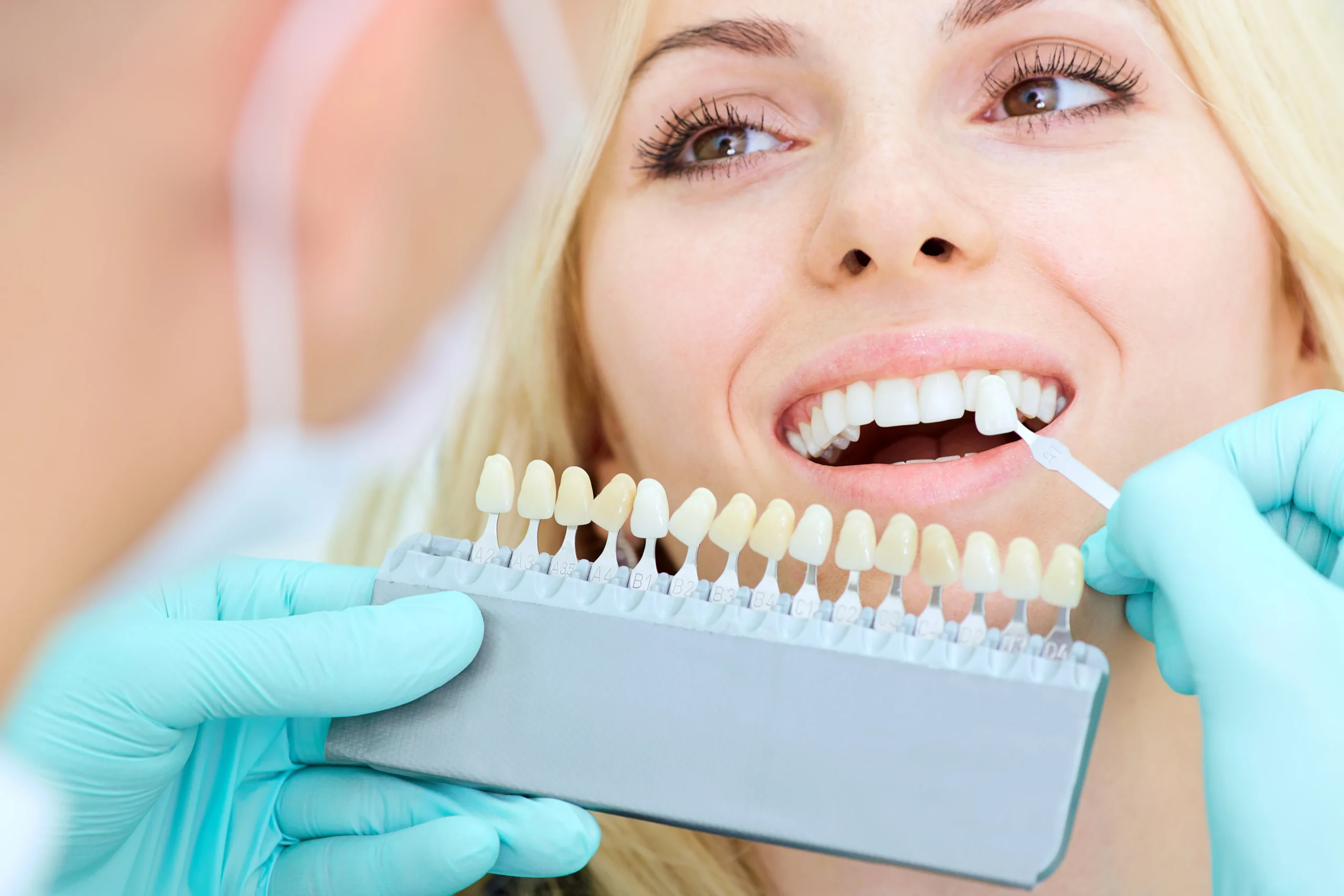 Teeth Whitening 101: A Popular Cosmetic Dentistry Solution