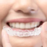 How Invisalign Aligners Improve Both Oral Health And Aesthetics