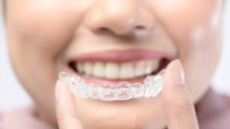 How Invisalign Aligners Improve Both Oral Health And Aesthetics
